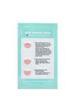 Load image into Gallery viewer, Acne Hydrocolloid Healing Patch - 1 pk