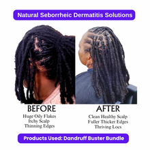 Load image into Gallery viewer, Dandruff Buster Bundle