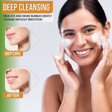 Load image into Gallery viewer, AMVital Turmeric Gel Cleanser