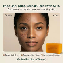Load image into Gallery viewer, AMVital Turmeric Kojic Acid Soap Bar for Dark Spots & Uneven Tone
