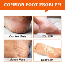 Load image into Gallery viewer, Cracked Heel Treatment , Cracked Feet, Heals and Moisturizes for Healthy Feet, Sweet Orange Scentl, 2.4 Oz
