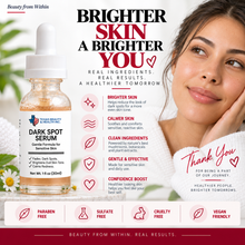 Load image into Gallery viewer, Dark Spot Serum for Sensitive Skin | Gentle Skin Brightening &amp; Even Tone Treatment Serum
