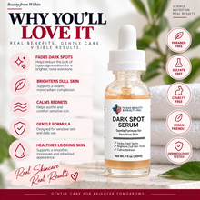 Load image into Gallery viewer, Dark Spot Serum for Sensitive Skin | Gentle Skin Brightening &amp; Even Tone Treatment Serum
