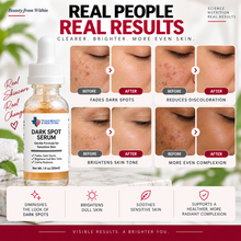 Load image into Gallery viewer, Dark Spot Serum for Sensitive Skin | Gentle Skin Brightening &amp; Even Tone Treatment Serum
