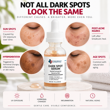 Load image into Gallery viewer, Dark Spot Serum for Sensitive Skin | Gentle Skin Brightening &amp; Even Tone Treatment Serum
