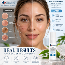 Load image into Gallery viewer, 10% Niacinamide Serum for Glowing, Pore-Minimized Skin | Hydrating Face Serum with Hyaluronic Acid
