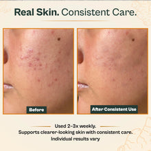 Load image into Gallery viewer, AMVital Turmeric Vitamin C Clay Mask
