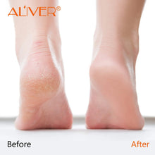 Load image into Gallery viewer, Cracked Heel Treatment , Cracked Feet, Heals and Moisturizes for Healthy Feet, Sweet Orange Scentl, 2.4 Oz
