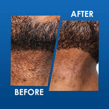 Load image into Gallery viewer, Odeon Skin &amp; Scalp Treatment, 3.5 Oz
