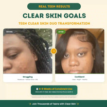 Load image into Gallery viewer, Teen Clear Skin Duo
