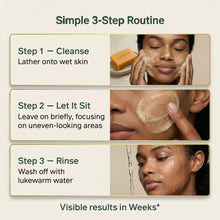 Load image into Gallery viewer, AMVital Turmeric Kojic Acid Soap Bar for Dark Spots &amp; Uneven Tone
